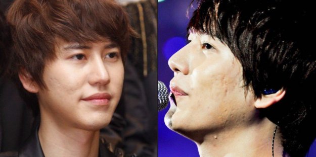 misc_1476491337_acne1